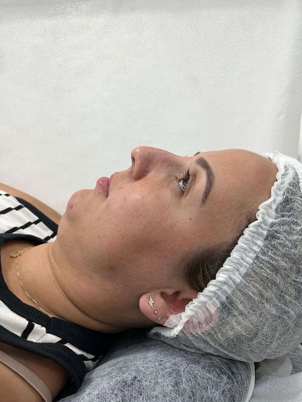 Resultado de procedimento 4